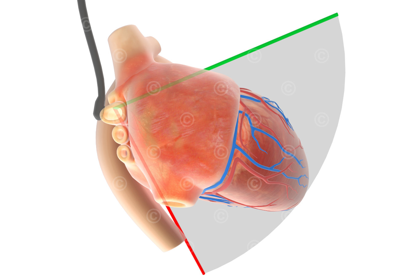 midesophageal long axis