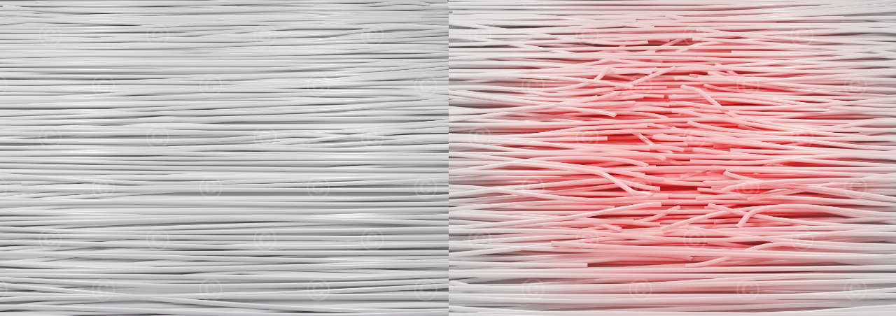 healthy tendon structure compared to damaged structure