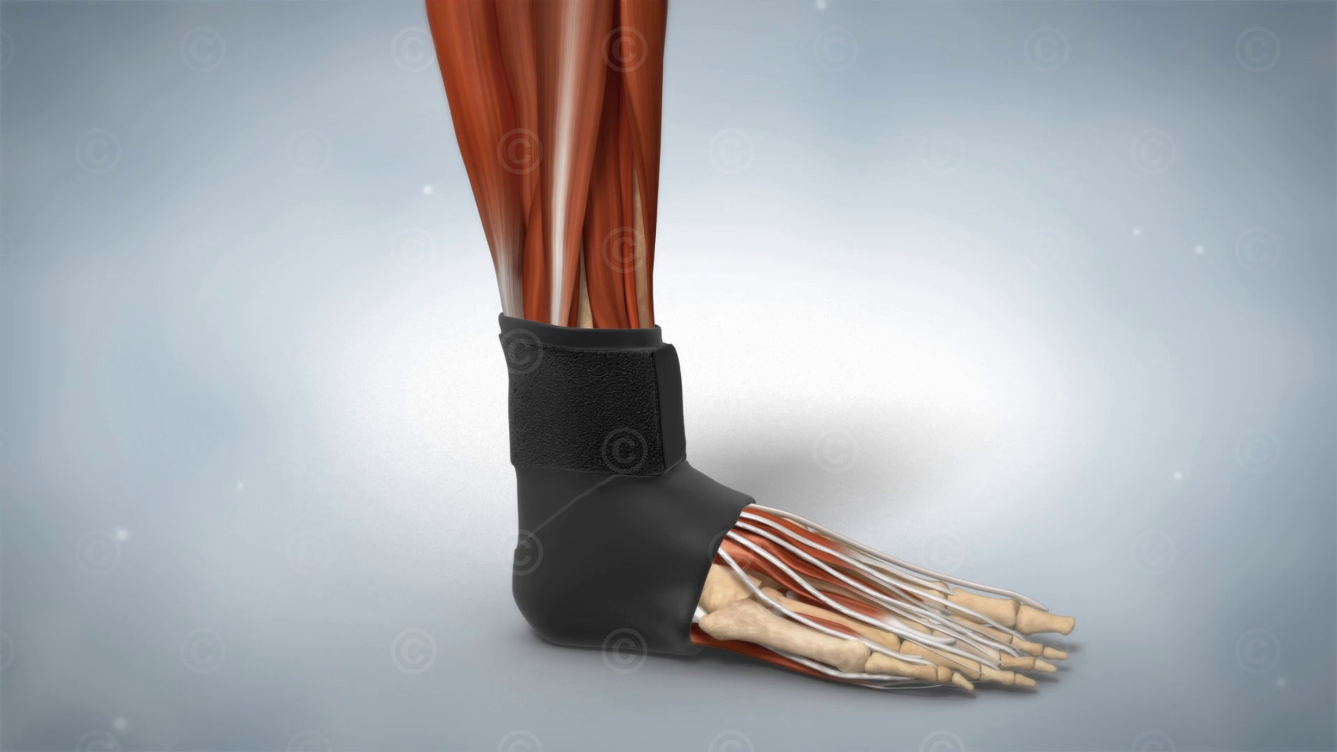 orthosis supporting ankle joint