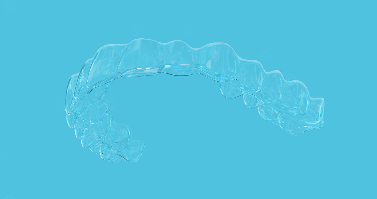 Aligner