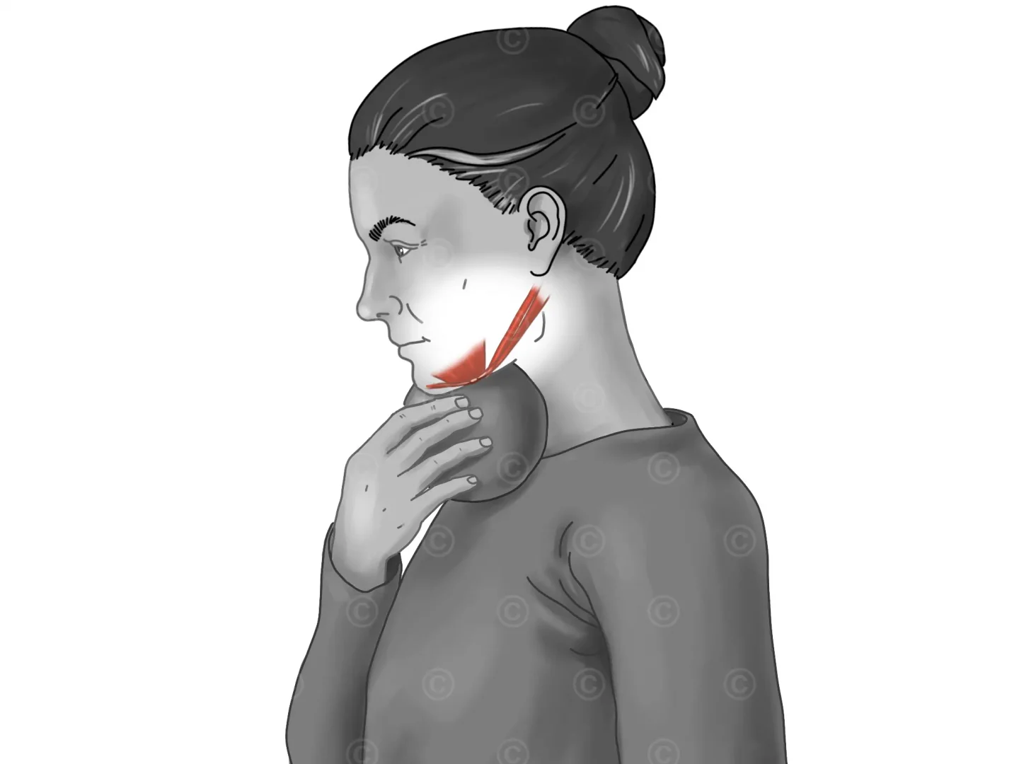Chin tuck against resistance exercise - CTAR - dysphagia