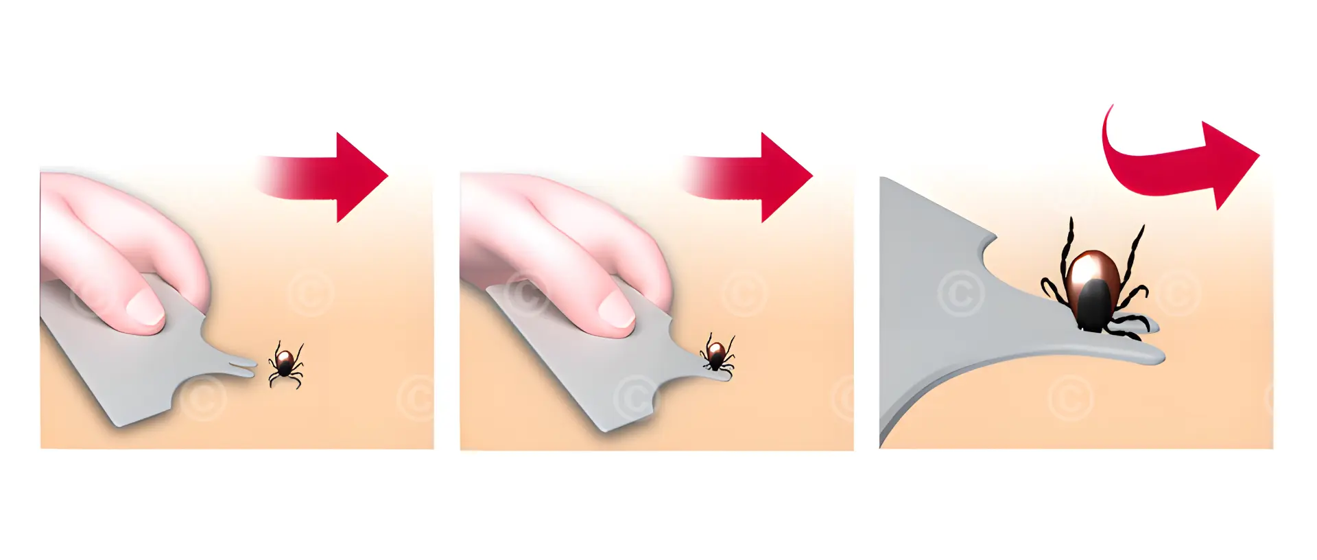 tick-removal-tick-card