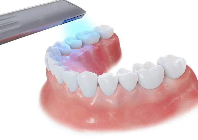 intraoral-3d-scan-lower-jaw
