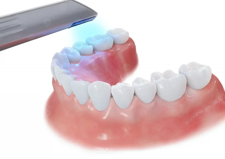 Intraoral 3D Scanner Unterkiefer