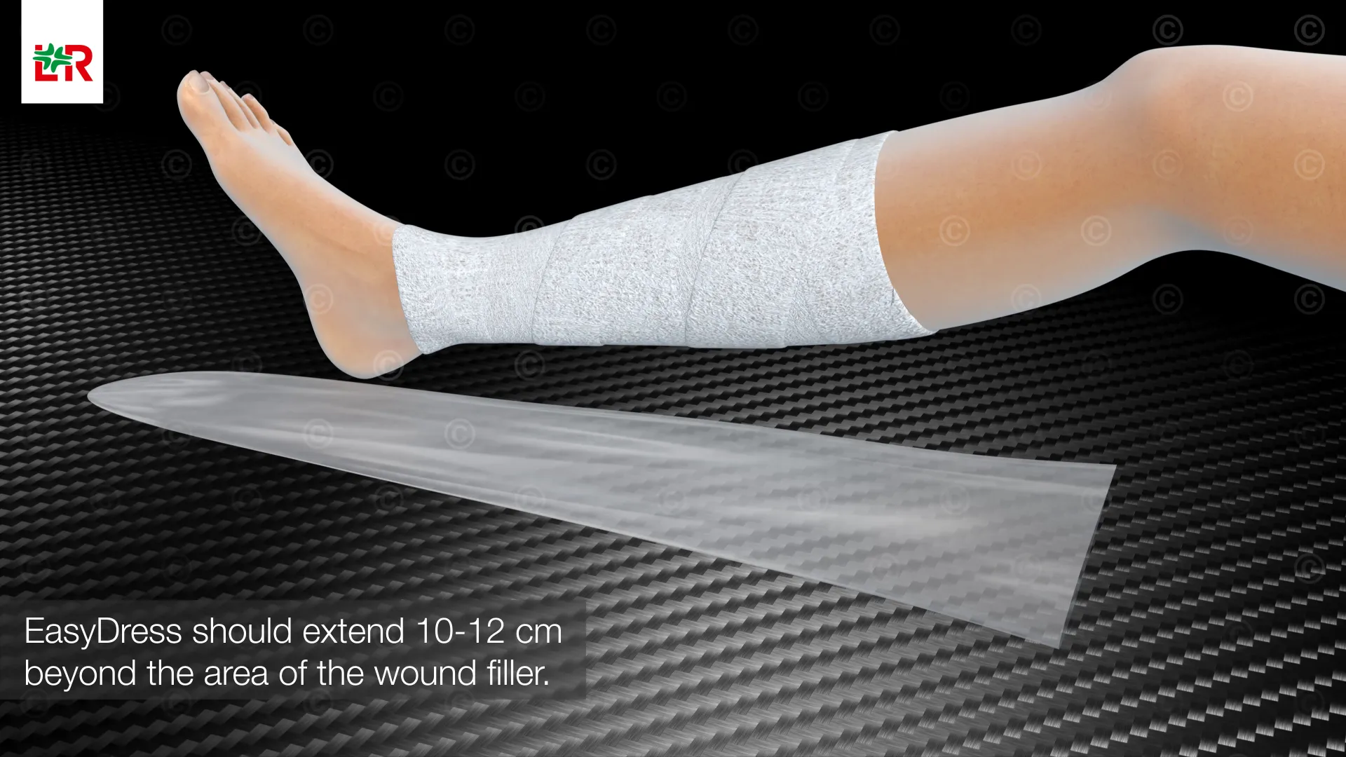 negative-pressure-therapy-leg