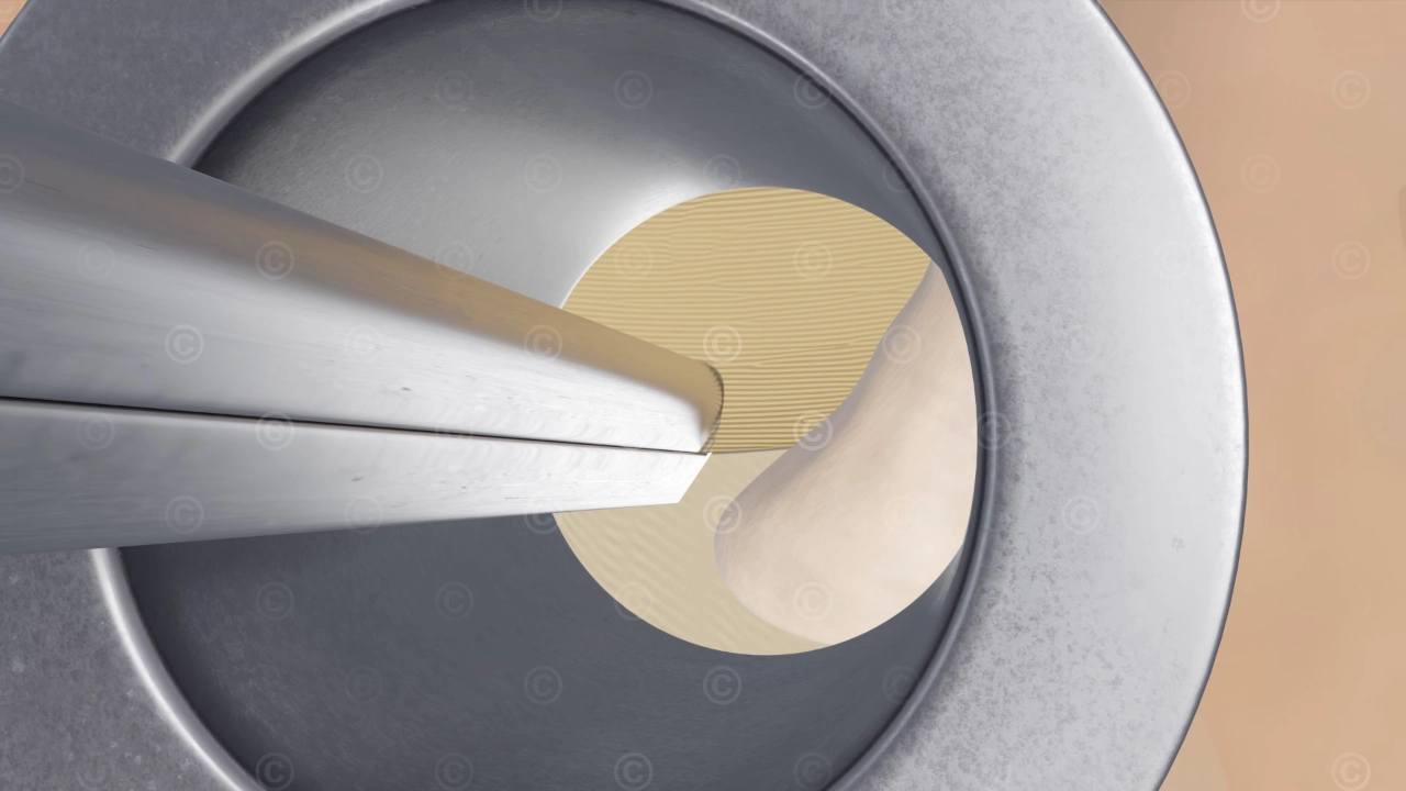 Dura mater - surgery tube