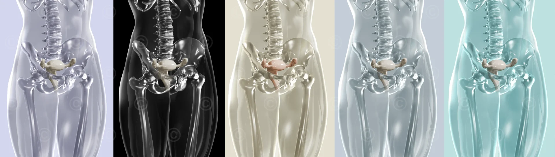 Illustration gynecology - color variations