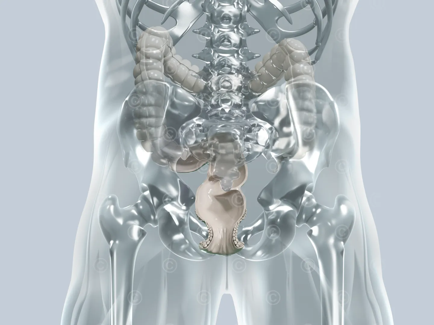 Illustration colorectal surgery - proctology