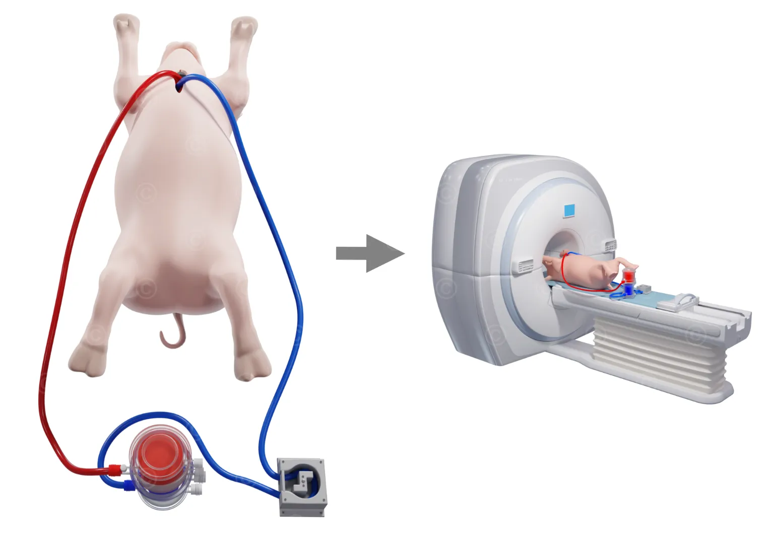 Workflow cardiopulmonary bypass and MRI