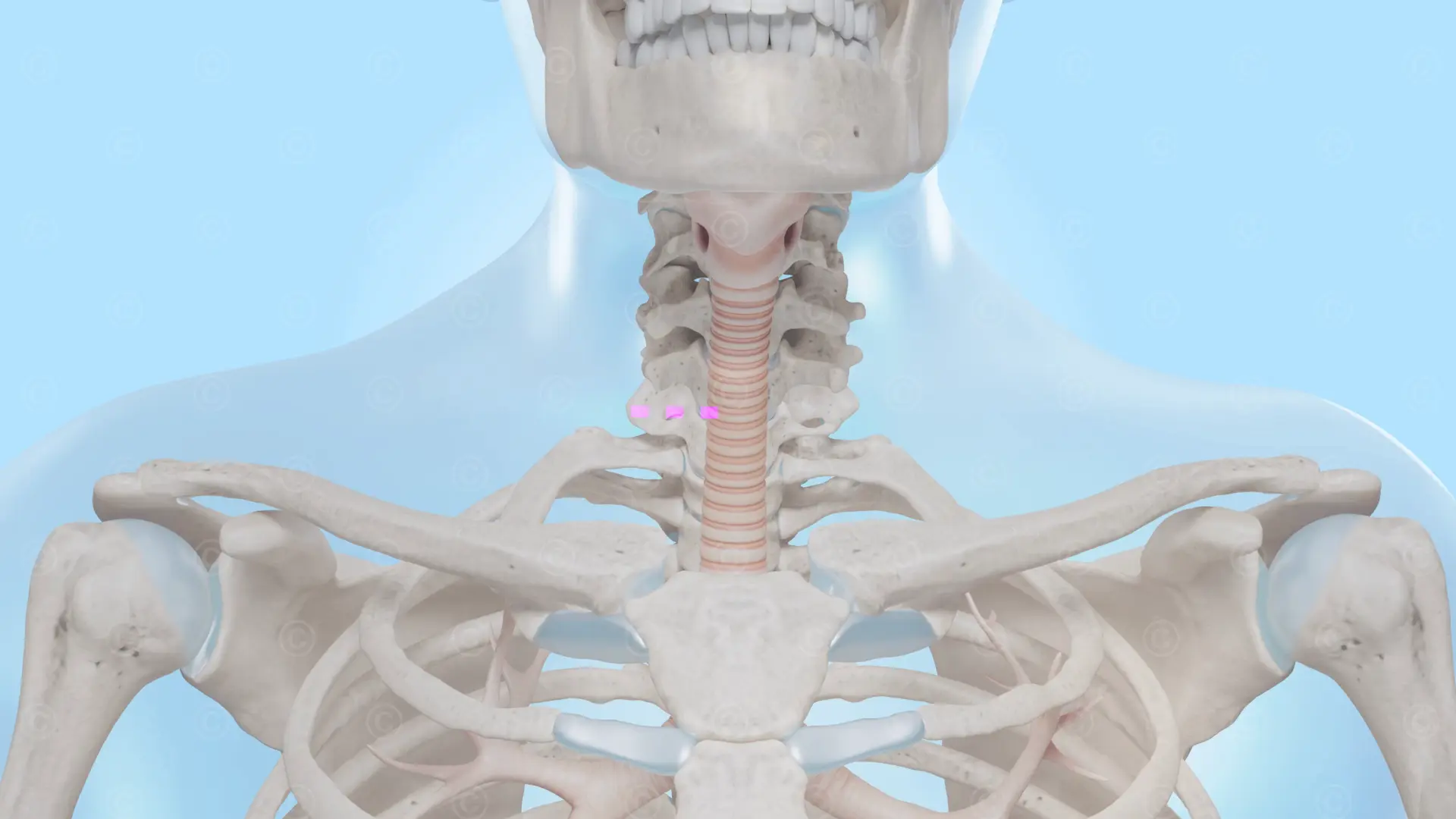 ACDF - surgery approach