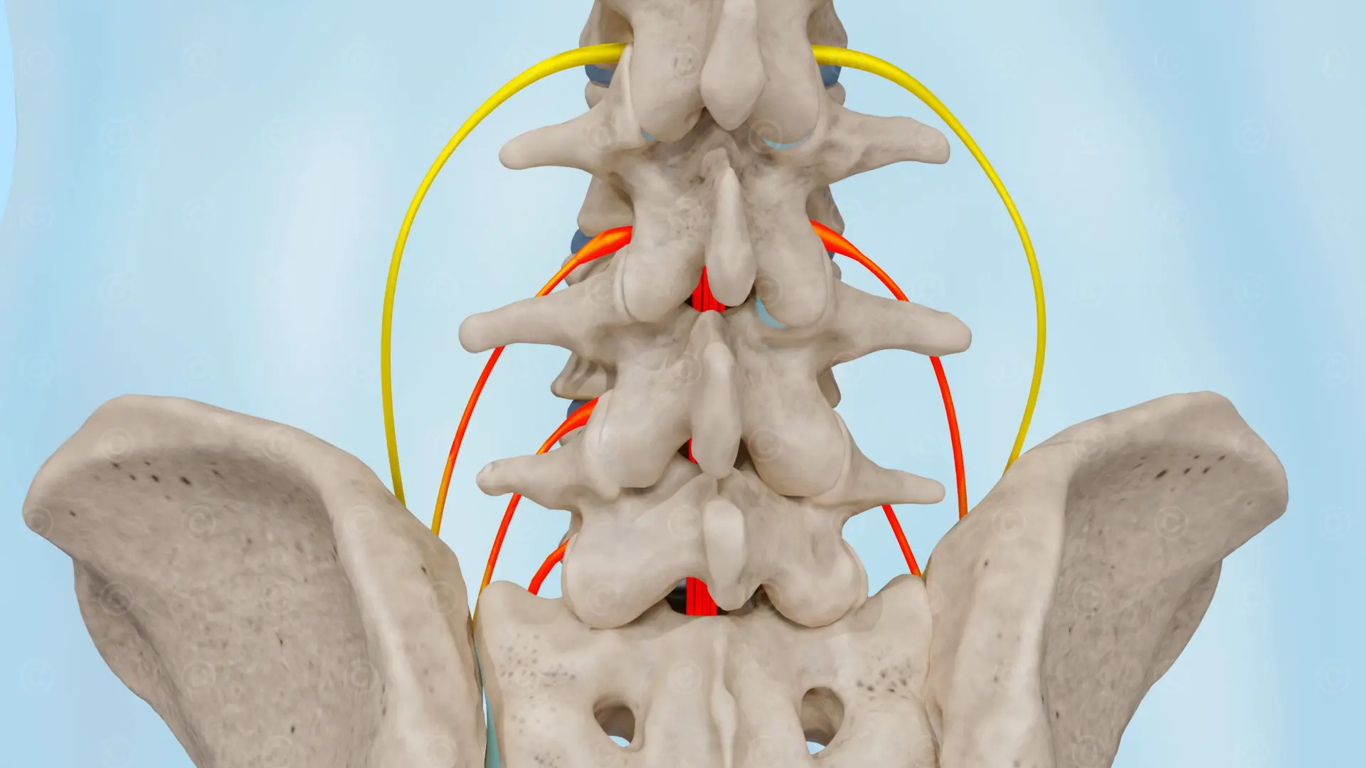 Schmerzen und Bewegungseinschränkungen - Spinalkanalstenose