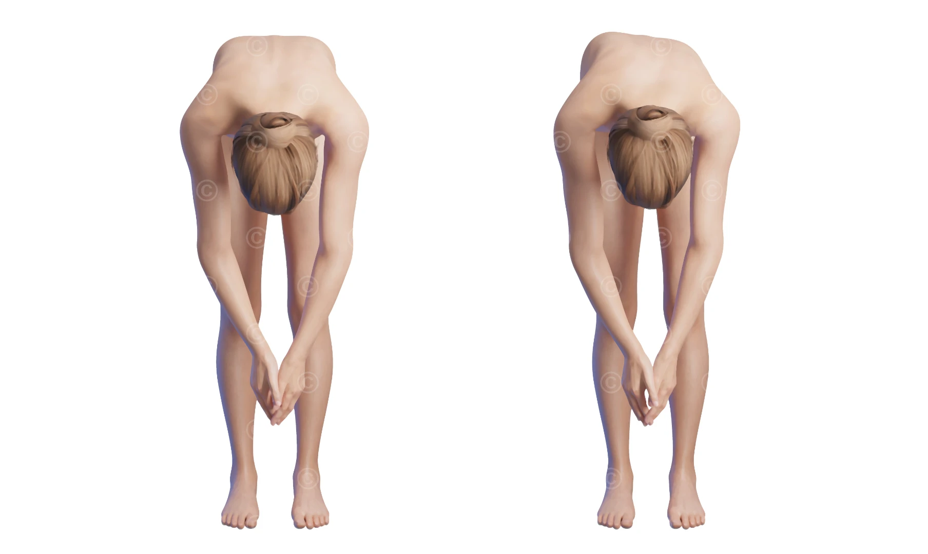Adams-Test Figur von vorne. Links gesund, rechts Skoliose
