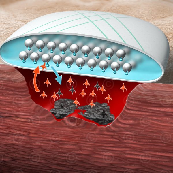 MOA-wound-dressing-big