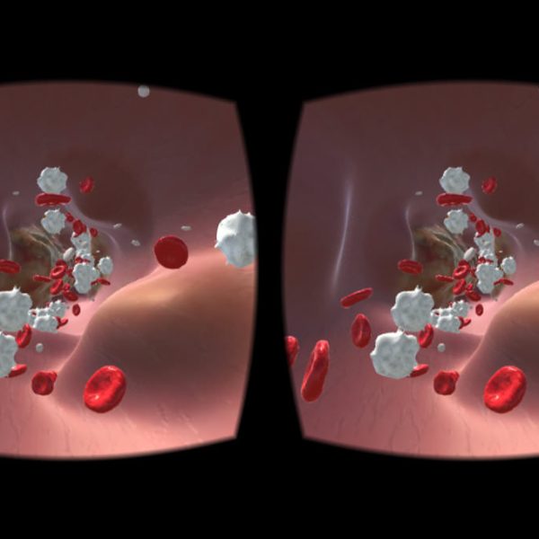 vr app diabetes verschluss vr app diabetes verschluss